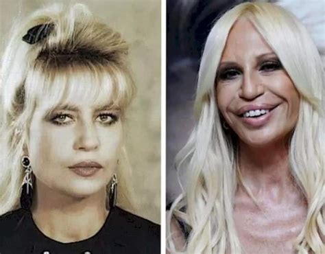 in che anno donatela versace|donatella versace face what happened.